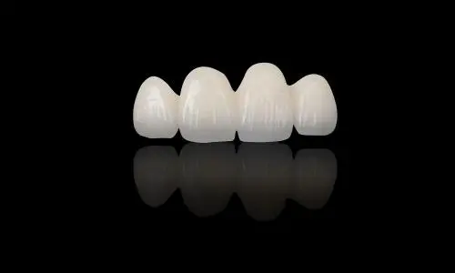 Why Choose Porcelain Layered Zirconia for Premium Dental Restorations?
